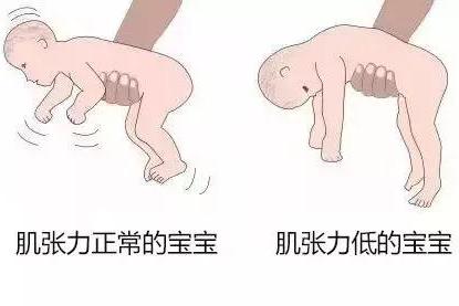 教你自测宝宝肌张力是否正常