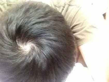 你家宝宝有几个头旋 预示孩子的聪明程度