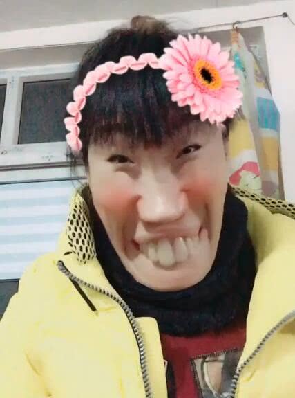 这二个大门牙可真磕碜