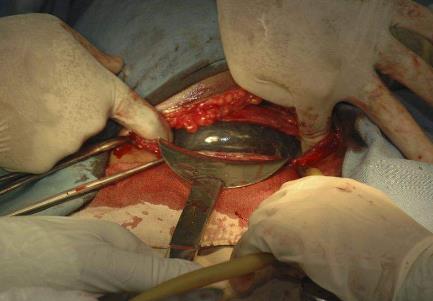 医生剖开产妇肚皮,顿时吓懵了,斥责:用命当赌注!