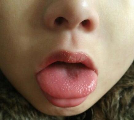 同时出现3-4个这样的症状, 说明婴儿身体"生虫"了|生虫|蛔虫病|婴儿