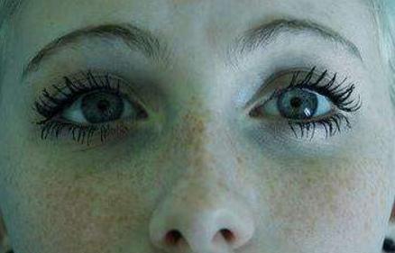 3个方法阻止黑色素沉着让你脸上斑点早点下斑