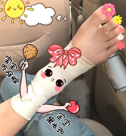 睢冉爱妻晒睢冉受伤脚踝:大姨伤愈仍是一条好汉