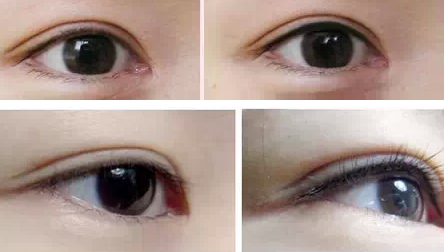 美瞳线后的真实效果