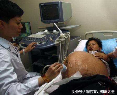 后来去医院检查的时候,涛姐都被吓的委屈大哭,报告单上写着是六胞胎!