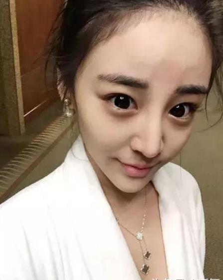 这里要表扬小姐姐没有过度加高山根,变成下面这种通天鼻.