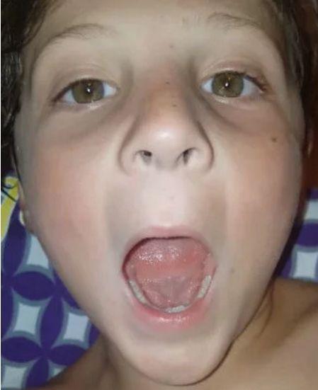 孩子最近天天捂着嘴喊疼,张大嘴巴一看,妈妈心疼