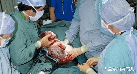 95后孕妇紧急"顺转剖"生娃, 抱出孩子后, 老公却当场大发雷霆!