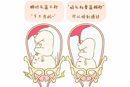 当事先诊断出由于胎头比母体的骨盆大,或者母体骨盆形状存在某种问题