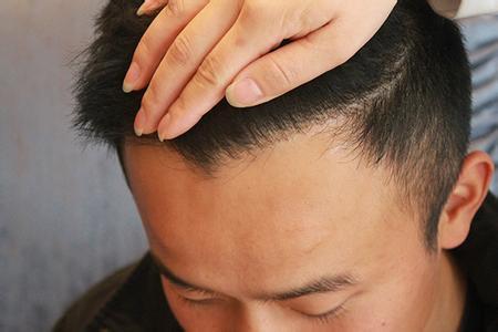 老人手比大拇指