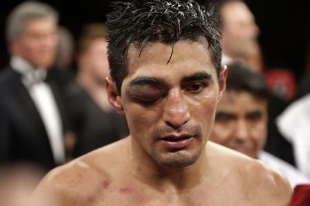 搏击拳手不好当!有些选手被打断手臂,更惨的双目失明!