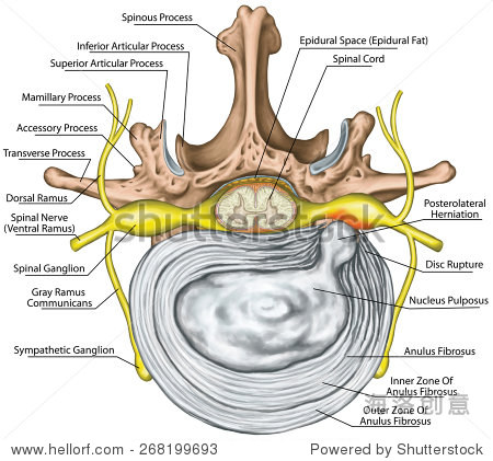 一个不起眼的东西就能解决腰椎间盘突出啊为家人自己收藏