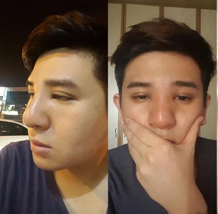 男子因外貌被女友抛弃 整容后成帅哥引网友讨论,就问你后悔了么