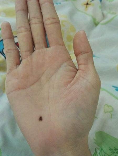 朱砂掌即微见红色的痣散发在双掌之中,掌色鲜润,主一生有财,他朝必