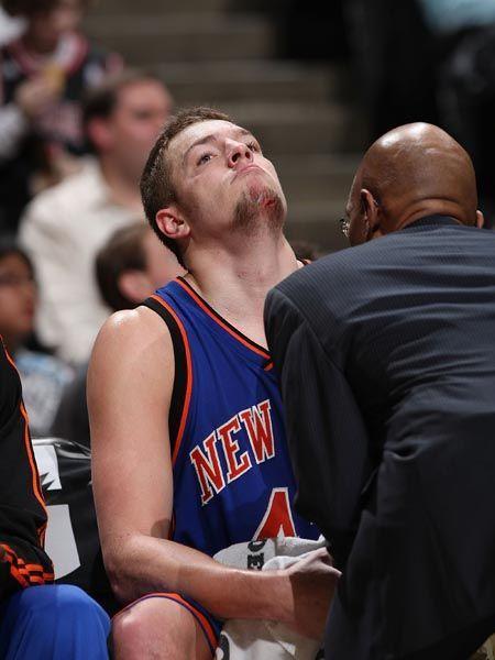 nba赛场上飙血的球星们,纳什浴血赛场,科比乔丹鼻子大出血