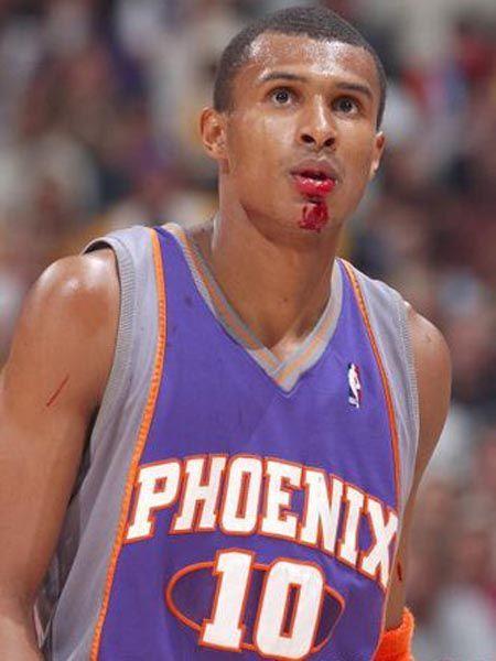 nba赛场上飙血的球星们,纳什浴血赛场,科比乔丹鼻子大出血