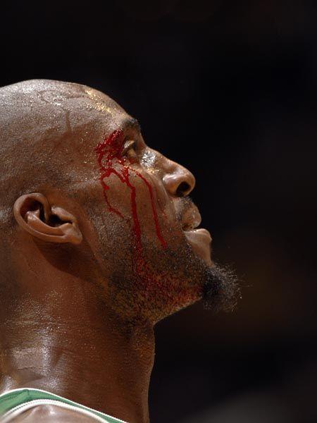 曾经血洒nba球场的球员们,如今都已经退役