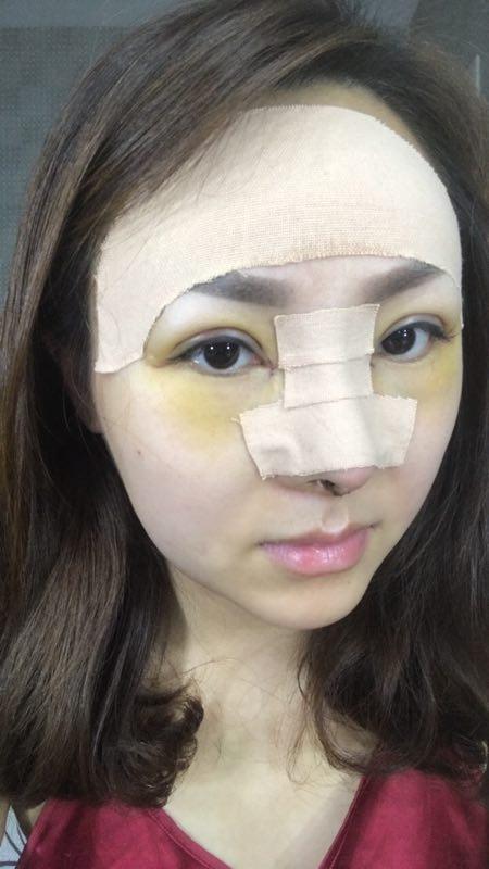 整容确实可以变美,但看完整容过程,只觉得满屏的疼痛!