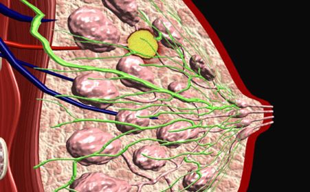 乳腺结节 实例图图片