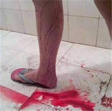 怀孕八个月忽然早产孩子出生抢救无效医生怒斥老公禽兽