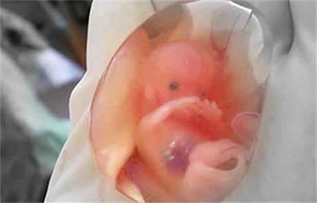 孕期腹中胎儿最怕的9件事, 孕妈再任性也不要做!