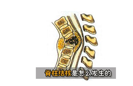 学会的受用一生,记得收藏|腰椎间盘突出|髓核|中医_新浪新闻