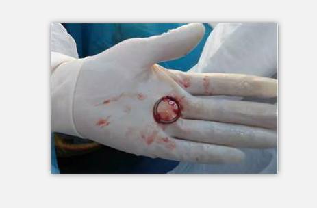 大多数女人做的这件事,99%的人以后都会后悔,会影响一辈子!