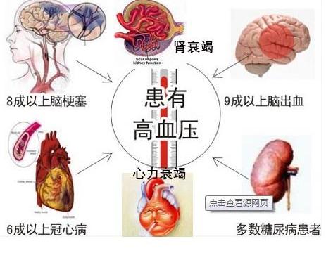高血压、高血脂、高血糖、高尿酸,降四高处方_新浪新闻