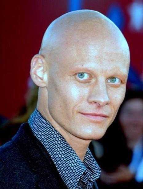 32款男士秃顶发型!