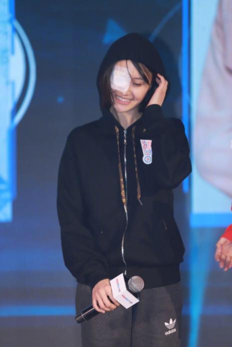 郑爽眼睛缠纱布上镜,她怎么总是受伤啊