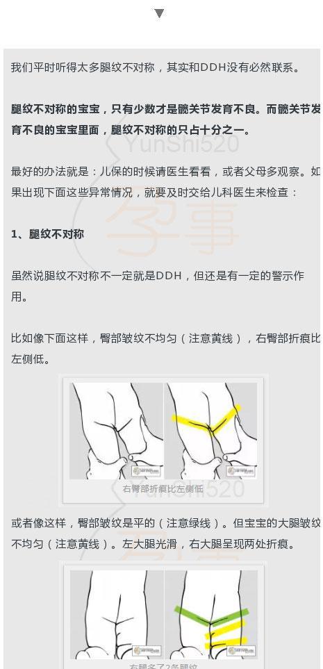 宝宝|不对称|髋关节_新浪新闻