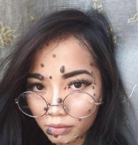 看一眼头皮发麻的斑点女孩网友有人敢娶吗