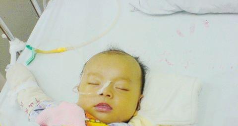 【病理性的黄疸对宝宝有什么害处】