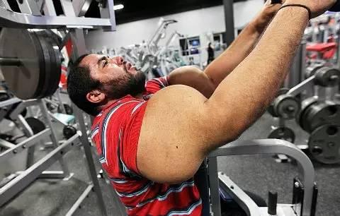 那个拥有世界上最粗手臂的男人如今终于要被截肢了