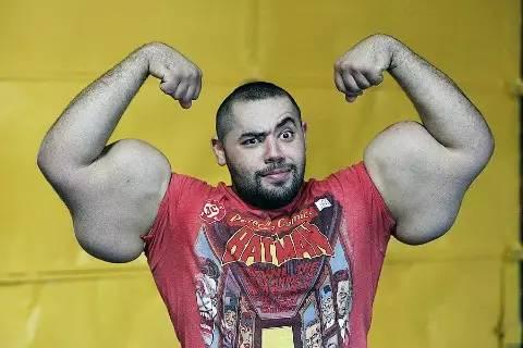 那个拥有世界上最粗手臂的男人如今终于要被截肢了