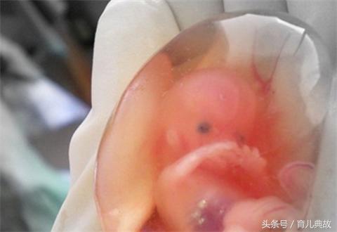 打胎药都没将胎儿打掉,看着怀中的宝宝就忍不住掉泪!