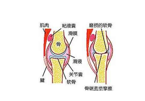 公布一个秘密那就是治疗滑膜炎的特效方法让你从此不再困扰