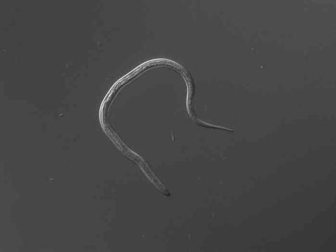 哪些食物含寄生虫 最危险的食物都有哪些