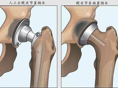 天津汽车置换补贴最新政策 汽车国家补贴什么时候结束