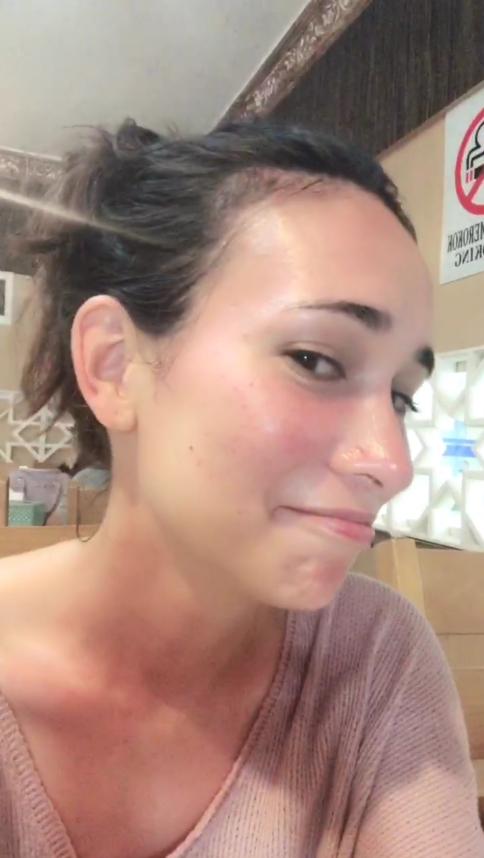 《战狼2》女主卢靖姗出海拍新戏晒伤,自拍脸和身上红红的挺辛苦