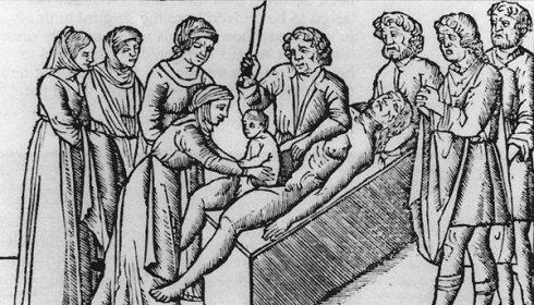 最尊贵的分娩:剖腹产古代很多皇子都是剖腹产出生的,可以说剖腹产是