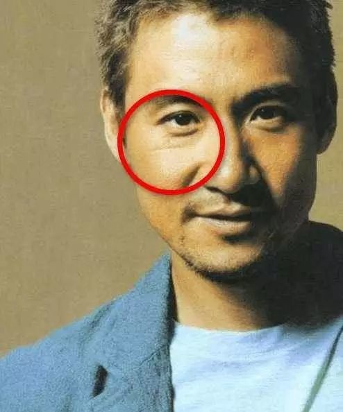 李鹤东脸上的疤图片图片