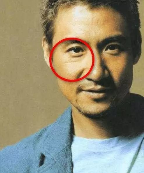 这10位明星脸上都有疤,郑爽被怀疑整容,杨幂自拍只爱拍半边脸!