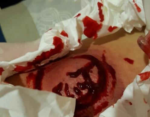 满手是血也要继续训练lol,snake水晶哥为中国电竞长脸了!