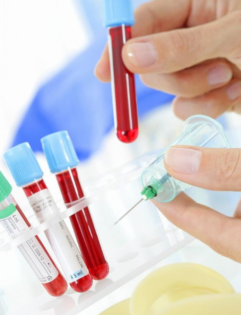 1,不定期查血尿酸