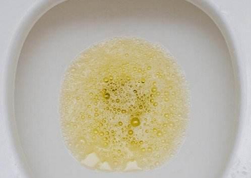 35岁男子尿流如花洒3年没重视查出肾衰竭,这些信号一定要重视!