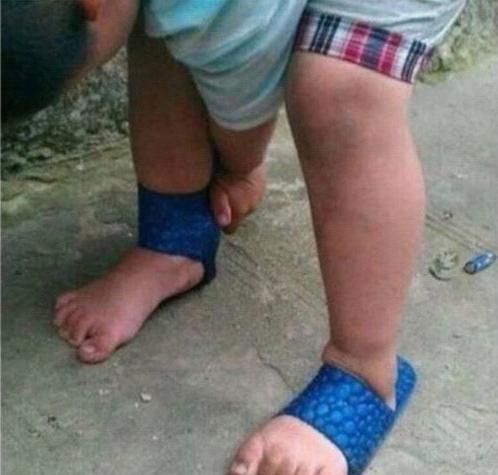 脚一滑,拖鞋快成护腕了       