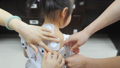 三伏贴给这样的宝宝贴可是会引起中毒的!