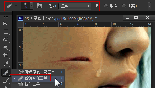 ps怎么去掉疤痕之教程修复画笔工具修复疤痕