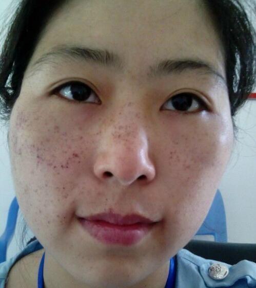 大嫂祛斑不花一分钱,每天仅用厨房里的它,半月肌肤重返20岁